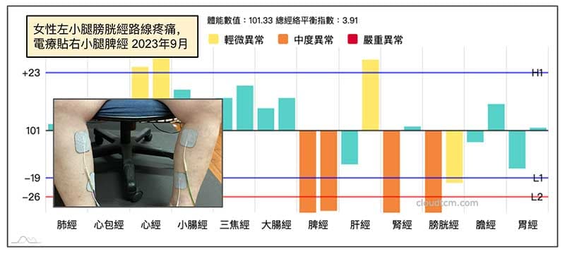 左小腿疼痛，右小腿貼電療貼片依然有效