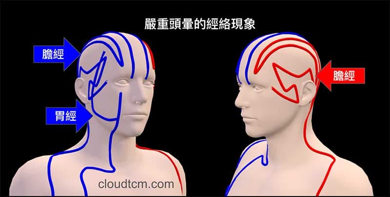 開啟3D模式，清楚看出頭部的經絡左右差異過大