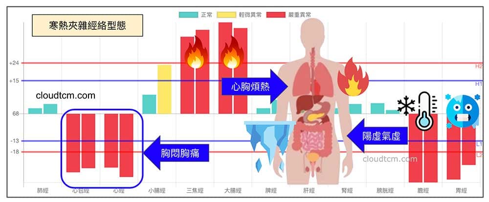 熱擾胸膈經絡型態，常常伴隨陽虛經絡型態